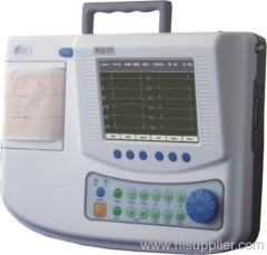 ECG