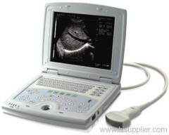 B Mode Ultrasound Scanner