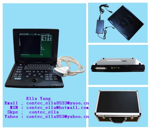 B-Ultrasound Scanner