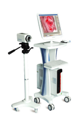 Video Colposcope