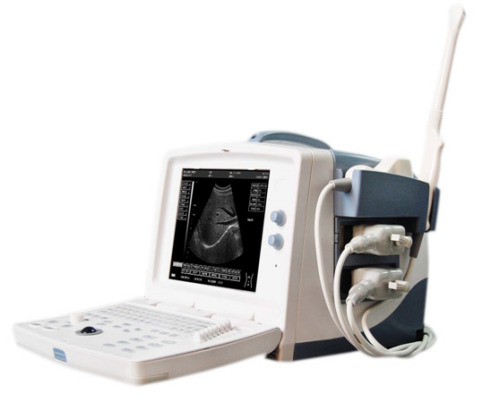 B-Ultrasound scanner