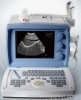 Ultrasound Scanner