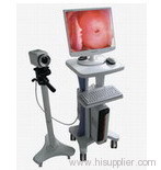 video colposcope