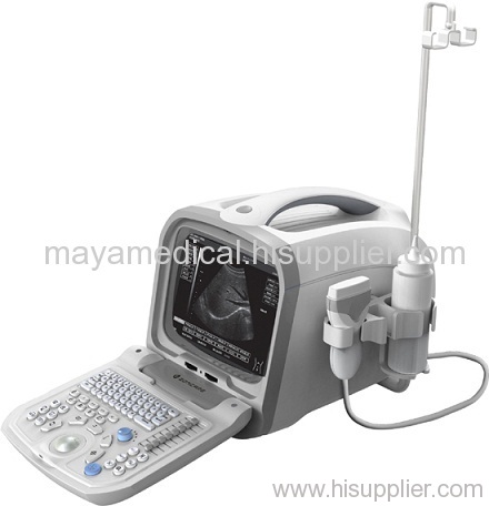B ultrasound scanner