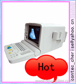 Ultrasound scanner