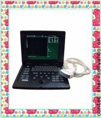 Palmsize Ultrasound scanner