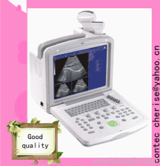 Ultrasound scanner