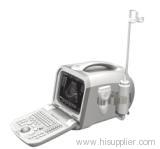 Digital ultrasound scanner