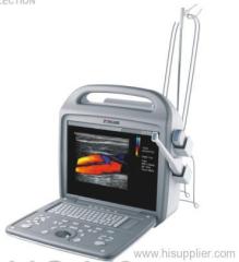 All digital color doppler