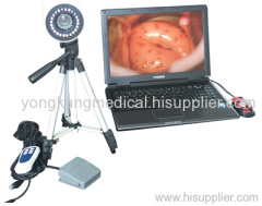 video colposcope system