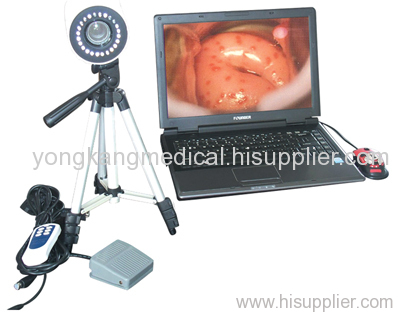 colposcopy