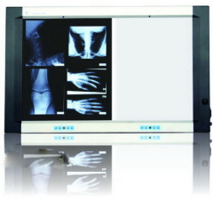 Medical X-Ray film viewer
