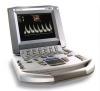 SonoSite Titan Ultra portable ultrasound Machine