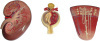 Kidney,Nephron,Glomerulus