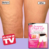 Instant Thigh Lift as seen on tv