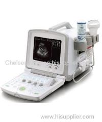 B-Ultrasound Diagnostic Scanner