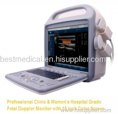 Fetal Monitor