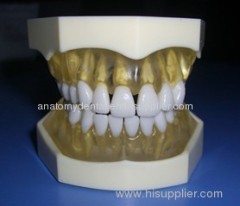 Transparent Gingivae 28 Removable Teeth