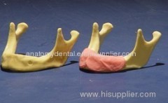 Implants Drilling Bone Grafting Gum Suturing