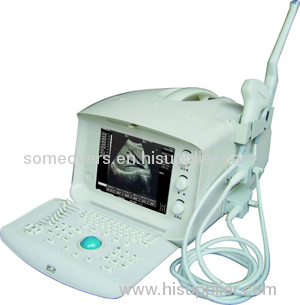 Portable Ultrasound Scanner OSEN600