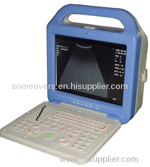 Portable Ultrasound Scanner OSEN600L