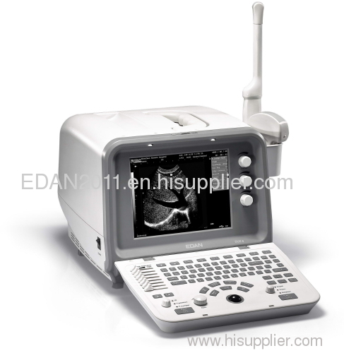 Ultrasound scanner ; medical diagnosis machine