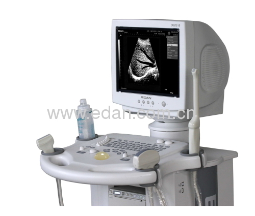 Ultrasound scanner ; medical diagnosis machine