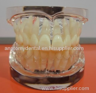 transparent model standard adult teeth