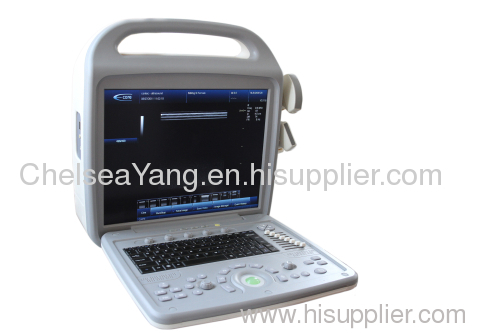 Color Doppler Ultrasonic Diagnostic System