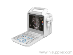 Color Doppler Ultrasonic Scanner