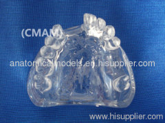 Wholesale - T-KM26B2 partial anodontia model , transparent dental model,dental model tooth model, oral ,Training