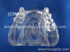 Wholesale - T-KM26B3 partial anodontia model , transparent dental model,dental model tooth model, oral ,Training