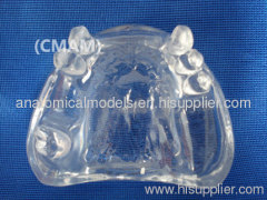 Wholesale - T-KM26B4 partial anodontia model , transparent dental model,dental model tooth model, oral ,Training