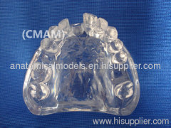 Wholesale - T-KM26B6 partial anodontia model , transparent dental model,dental model tooth model, oral ,Training