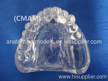 Wholesale - T-KM26B7 partial anodontia model , transparent dental model,dental model tooth model, oral ,Training