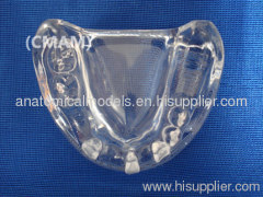 Wholesale - T-KM26B9 partial anodontia model , transparent dental model,dental model tooth model, oral ,Training