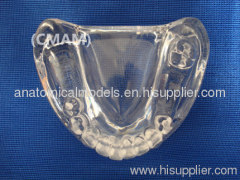 Wholesale - T-KM26B10 partial anodontia model , transparent dental model,dental model tooth model, oral ,Training