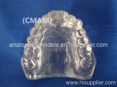 Wholesale - T-KM26B12 partial anodontia model , transparent dental model,dental model tooth model, oral ,Training