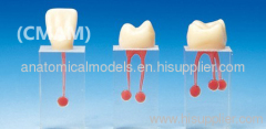 402,Root canal Model (S7 series),3pcs each set, Endodontics Area, Dental Training Products