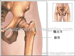 X-ray inkjet printing medical film