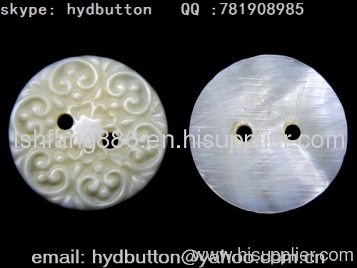 china button manufacture