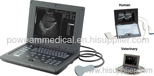 Digital Notebook Ultrasound Scanner