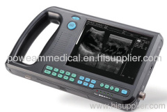 Palmtop Digital Ultrasound Scanner