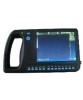 B-Ultrasound Diagnostic Scanner