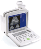 B-Ultrasound Diagnostic Scanner