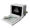 Full-digital ultrasound scanner