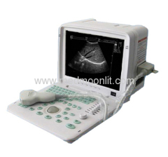 Full-digital ultrasound scanner