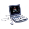 MINDRAY M5 Digital Ultrasound