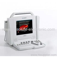 Siemens Acuson Cypress Portable Ultrasound