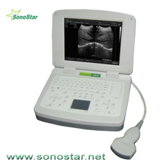 SS-9 Ultrasound B scanner(LCD screen)